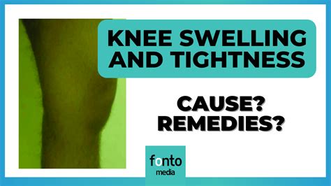 Dealing With Knee Swelling And Tightness Causes And Remedies