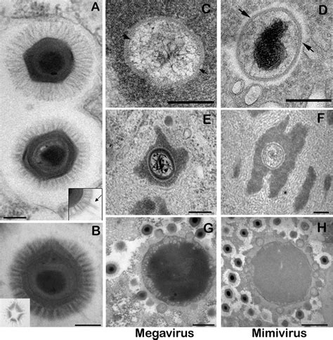 Electron Microscopy Of Megavirus Compared With Mimivirus A Mimivirus Download Scientific