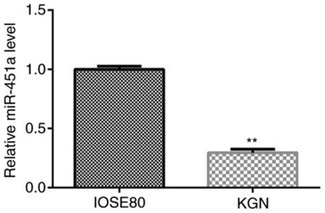 Microrna‑451a Plays A Role In Polycystic Ovary Syndrome By Regulating