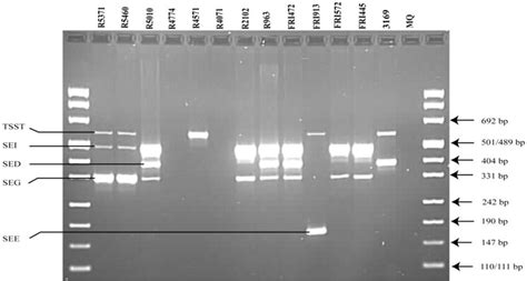 Agarose Gel Electrophoresis Of Pcr Products Amplified With The Modified