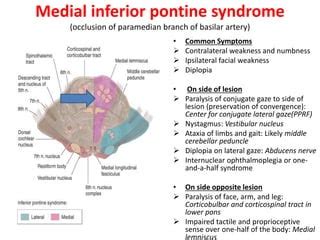 Pons anatomy and syndromes | PPT