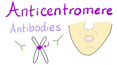 Anticentromere Antibodies - YouTube