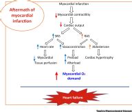 Epoxyeicosatrienoic Acid As Therapy For Diabetic And Ischemic