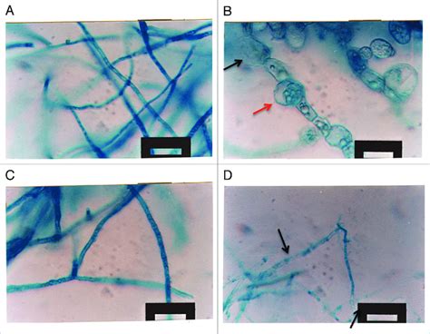 Morphological Changes In Phytopathogenic Fungi By Diffusible And