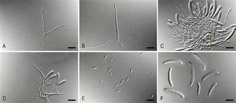 Pleiocarpon Strelitziae Ex Type Cbs 142251 Ab Simple Download