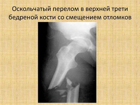 Общие принципы обследования и диагностики травматологических и ...