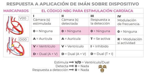 Utilidad Del Imán En El Portador De Marcapasos Respuesta Magnética Del