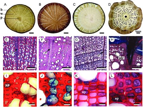 Anatomy Of Young Woody Roots And Stems At Three Different Download