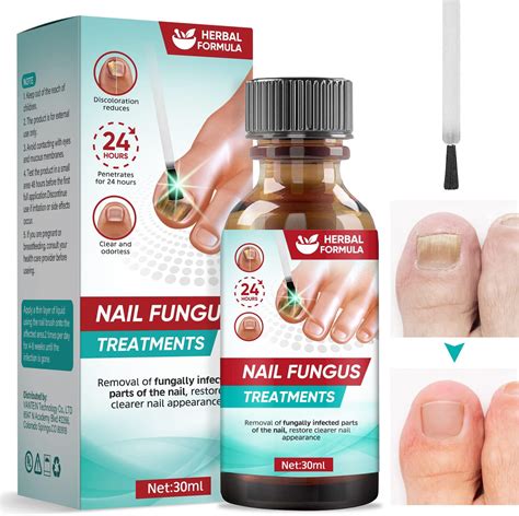 Amazon Toenail Fungus Treatment Extra Strength Nail Fungus