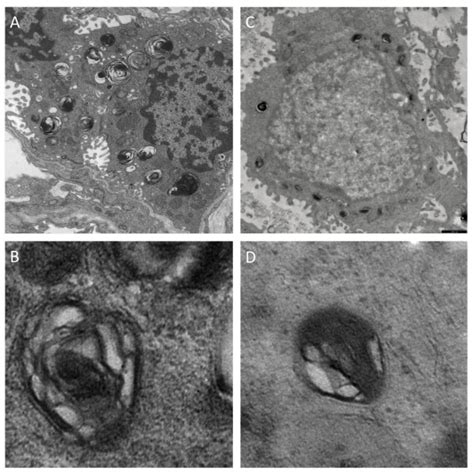 Alveolar Type Ii Cell Ultrastructure Transmission Electron Microscopy