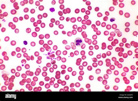 Human White Blood Cells Under Microscope