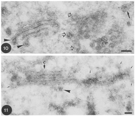 fig  anti clathrin labeling   trans golgi region
