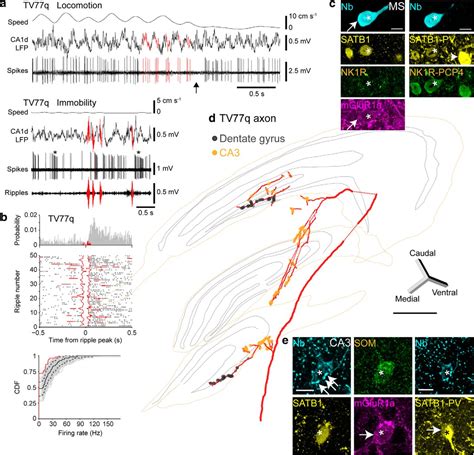 Gabaergic Medial Septal Neurons With Low Rhythmic Firing Innervating