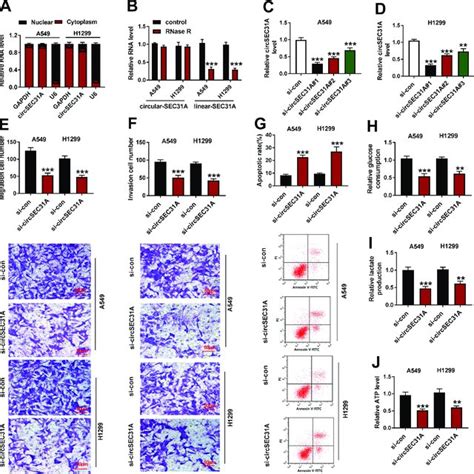 Circsec31a Knockdown Hindered Nsclc Cell Migration Invasion Download Scientific Diagram