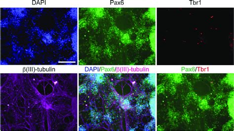 Progenitor Cells Express Markers Of Cortical Neurogenesis At Day 25 Of