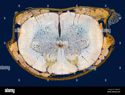 Real Spinal Cord Cross Section