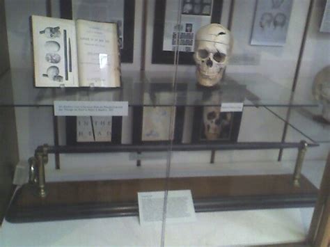 The skull of Phineas Gage, along with the tamping iron which did the damage to his skull & brain ...