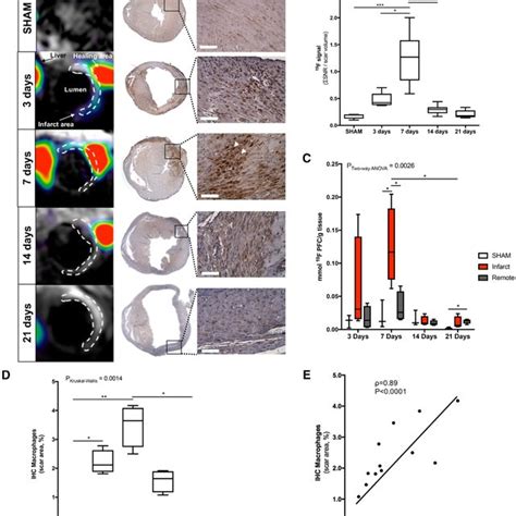 In Vivo Imaging Of Extracellular Matrix Remodeling After Myocardial