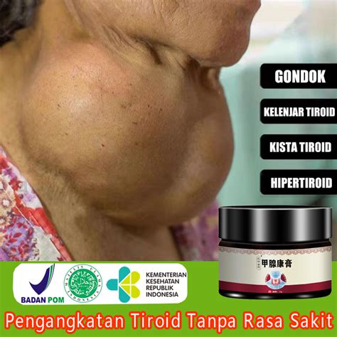 Jual Tiroid Leher Obat Gondok Kelenjar Tiroid Thyroid 35g Benjolan Di