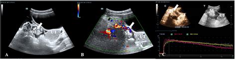 Frontiers Contrast Enhanced Ultrasonography For Differential