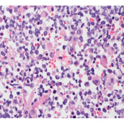 Gross And Microscopic Findings A Hematoxylin And Eosin H E Stain