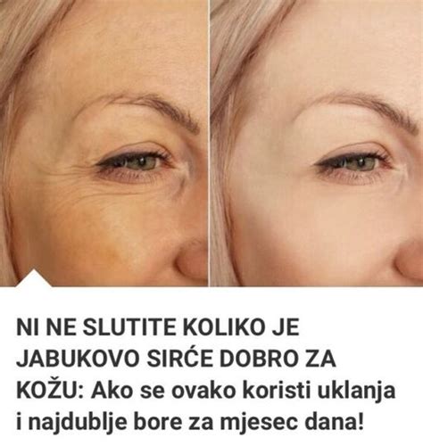 NI NE SLUTITE KOLIKO JE JABUKOVO SIRĆE DOBRO ZA KOŽU Ako Se Ovako