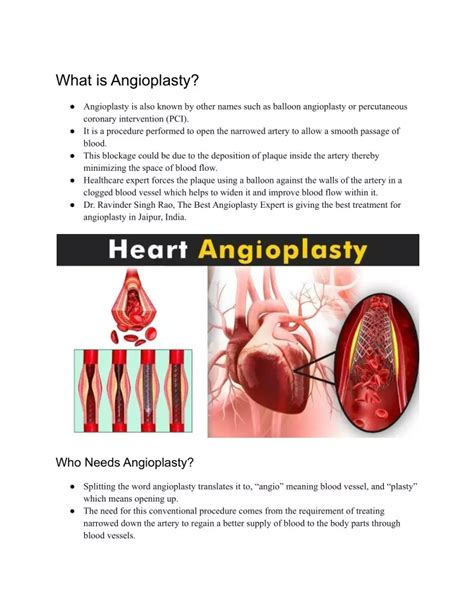 Ppt Angioplasty In India Dr Ravinder Singh Rao Powerpoint