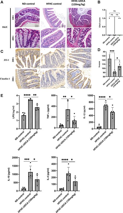 Frontiers Ursodeoxycholic Acid Treatment Restores Gut Microbiota And