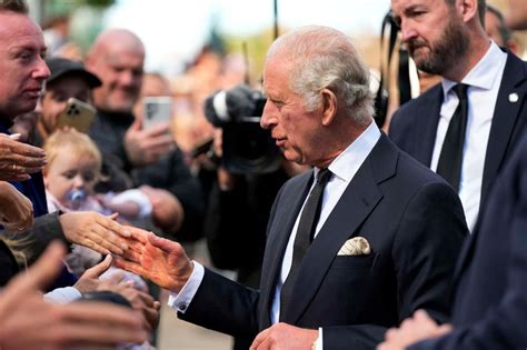 King Charles Iiis Hands Turn Red And Raw During Wales Greetings