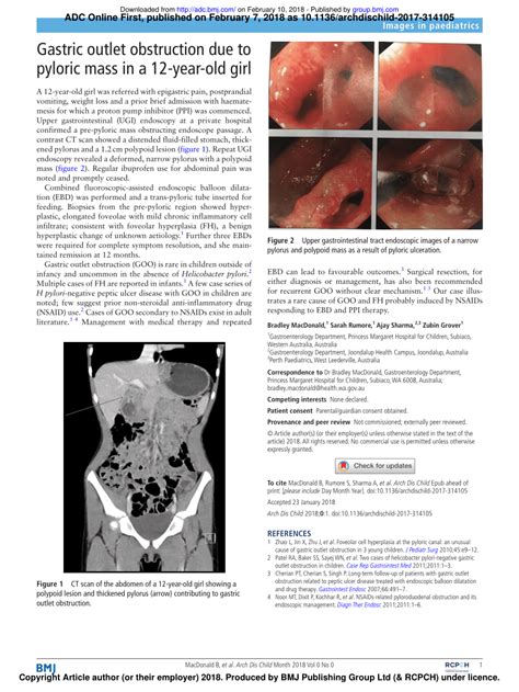 PDF Gastric Outlet Obstruction Due To Pyloric Mass In A 12 Year Old Girl