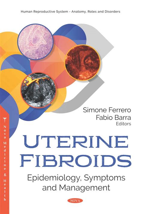 Uterine Fibroids Epidemiology Symptoms And Management Nova Science