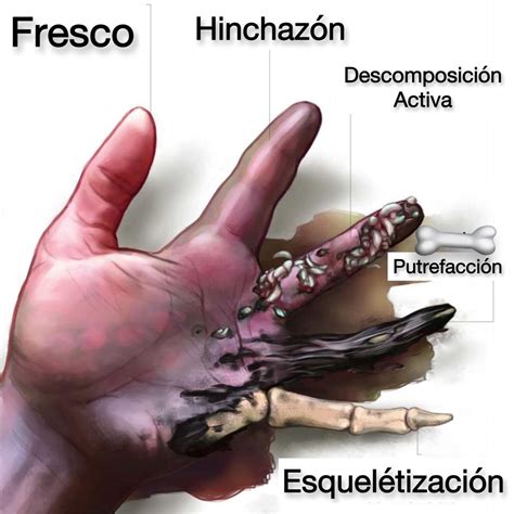 Criminology Mbti Fresco Peace Gesture Medical Health Miraculous