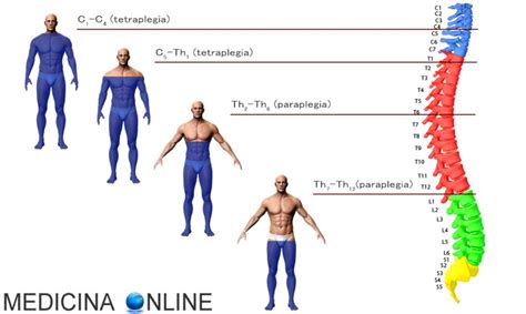 Shock Neurogeno Cause Sintomi Rischi Diagnosi Terapie Prognosi