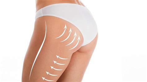 Non Surgical Butt Lift Manhasset Med Spa