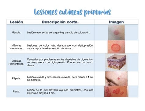 Lesiones Cut Neas Primarias Tabla Medicina Zip Udocz