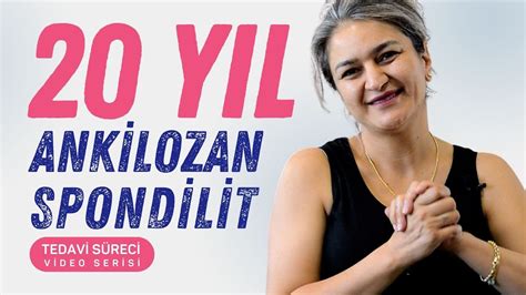 Ankilozan Spondilit Tedavisi Sevcan Taşçıer YouTube