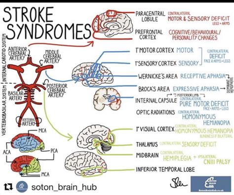 Strokes And Localization Flashcards Quizlet