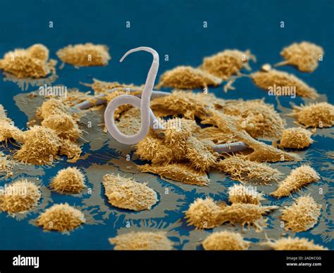 Macrophages Attacking Parasitic Larva Coloured Scanning Electron