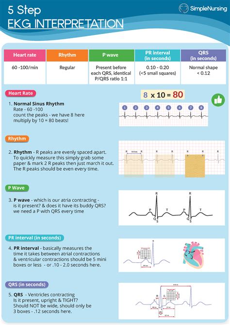 1. 5 Step EKG Interpretation - 5 Step EKG INTERPRETATION Heart rate ...