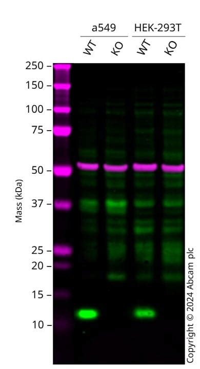 beta 2 Microglobulin重组抗体 EP2978Y beta 2 Microglobulin抗体 ab214769