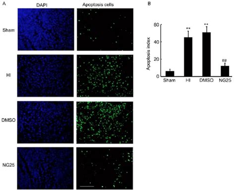 Apoptosis Detection By Tunel Assay In The Brain Cortex A