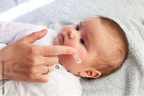 Baby With Atopic Dermatitis Getting Cream Put Care And Prevention Of