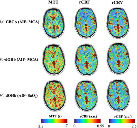 Perfusion Maps Of Mean Transit Time MTT Relative Cerebral Blood Flow