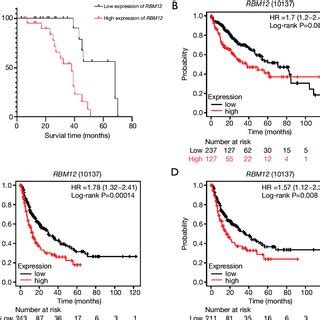 A High Expression Of Rbm Indicates Poor Prognosis In Hcc Patients