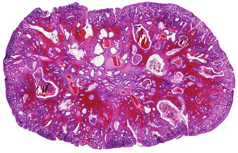 Histologic Structure Of Juvenile Polyp H And E Download Scientific Diagram