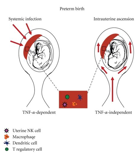 Roads To Preterm Birth Pathogens May Enter The Placental Blood Supply