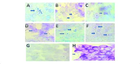 | Adhesion of S. thermophilus cells on HT-29 cell cultures observed ...