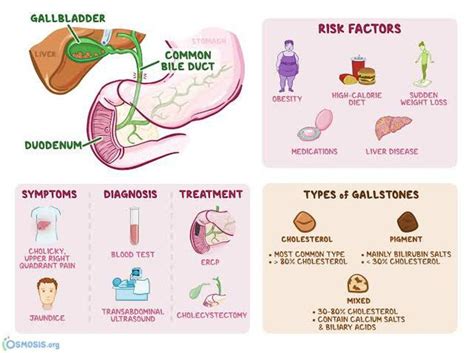 Treatment Of Choledocholithiasis MEDizzy