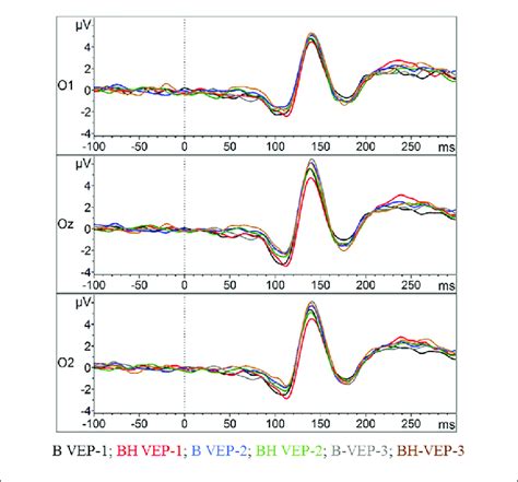 Visual Evoked Potentials VEPs In The Checker Board Task The