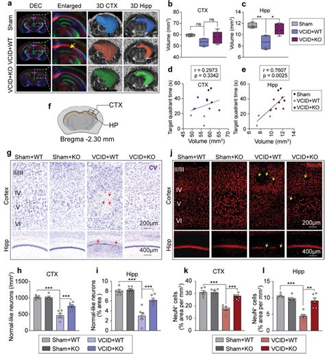 Mir A Genetic Deletion Protects Against Longterm Myelin Loss